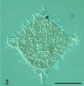 Dinoflagellaten-Cyste